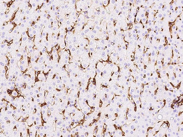 HLA-DR Antibody - Immunochemical staining HLA-DR in human liver with rabbit polyclonal antibody at 1:10000 dilution, formalin-fixed paraffin embedded sections.