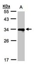 HLA-DR Beta Antibody - Sample (30 ug whole cell lysate). A: Raji . 12% SDS PAGE. HLA-DR Beta antibody diluted at 1:1000