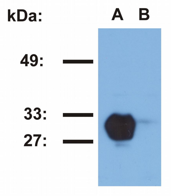 HLA-DR1 Antibody - Western blotting analysis of HLA-DR1 in Raji (A) and Jurkat (B) cell lines using MEM-267 antibody.