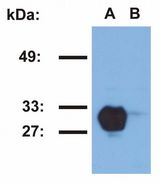 HLA-DR1 Antibody - HLA-DR1 Antibody in Western Blot (WB)
