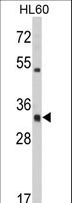 HLA-DRA Antibody - Western blot of HLA-DRA Antibody in HL60 cell line lysates (35 ug/lane). HLA-DRA (arrow) was detected using the purified antibody.
