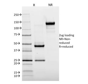 HLA-DRA Antibody - SDS-PAGE analysis of purified, BSA-free HLA-DR antibody (clone TAL 1B5) as confirmation of integrity and purity.