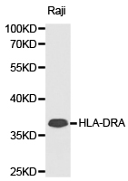 HLA-DRA Antibody - Western blot of extracts of Raji cell lines, using HLA-DRA antibody.
