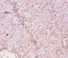HLA-DRA Antibody - Immunohistochemistry of paraffin-embedded human tonsil tissue using HLA-DRA Antibody at dilution of 1:20