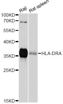 HLA-DRA Antibody - Western blot analysis of extracts of various cell lines, using HLA-DRA antibody at 1:1000 dilution. The secondary antibody used was an HRP Goat Anti-Rabbit IgG (H+L) at 1:10000 dilution. Lysates were loaded 25ug per lane and 3% nonfat dry milk in TBST was used for blocking. An ECL Kit was used for detection and the exposure time was 90s.
