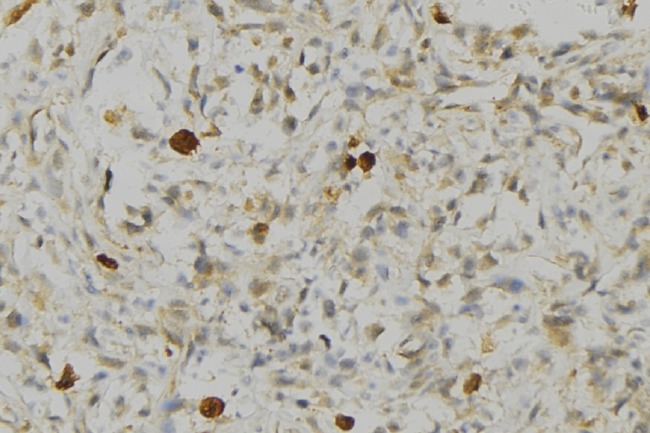 HLA-DRA Antibody - 1:100 staining human gastric tissue by IHC-P. The sample was formaldehyde fixed and a heat mediated antigen retrieval step in citrate buffer was performed. The sample was then blocked and incubated with the antibody for 1.5 hours at 22°C. An HRP conjugated goat anti-rabbit antibody was used as the secondary.