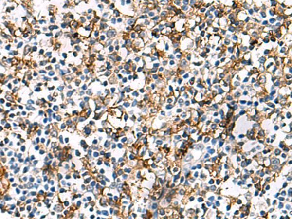 HLA-DRA Antibody - Immunohistochemistry of paraffin-embedded Human tonsil tissue  using HLA-DRA Polyclonal Antibody at dilution of 1:30(×200)