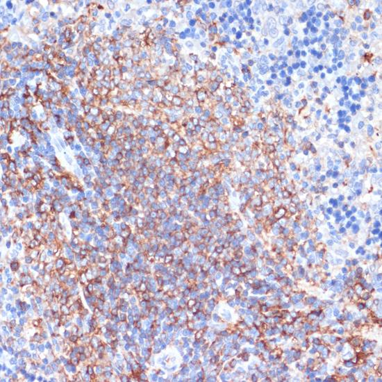 HLA-DRA Antibody - Immunohistochemistry of paraffin-embedded Rat spleen using HLA-DRA Polyclonal Antibody at dilution of 1:100 (40x lens).