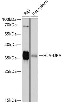 HLA-DRA Antibody - Western blot analysis of extracts of various cell lines using HLA-DRA Polyclonal Antibody at dilution of 1:1000.