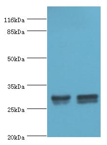 HLA-DRB1 Antibody - Western blot. All lanes: HLA-DRB1 antibody at 2 ug/ml. Lane 1:A375 cells. Lane 2: Raji cells. Secondary antibody: Goat polyclonal to rabbit at 1:10000 dilution. Predicted band size: 30 kDa. Observed band size: 30 kDa.  This image was taken for the unconjugated form of this product. Other forms have not been tested.