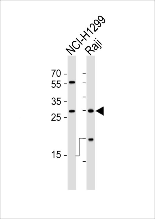 HLA-DRB1 Antibody - Western blot of lysates from NCI-H1299, Raji cell line (from left to right), using HLA-DRB1 Antibody. Antibody was diluted at 1:1000 at each lane. A goat anti-rabbit IgG H&L (HRP) at 1:5000 dilution was used as the secondary antibody. Lysates at 35ug per lane.