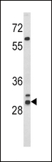 HLA-DRB1 Antibody - Western blot of HLA-DRB1 Antibody in WiDr cell line lysates (35 ug/lane). HLA-DRB1 (arrow) was detected using the purified antibody.