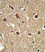 HLA-DRB1 Antibody - Formalin-fixed and paraffin-embedded human brain tissue reacted with HLA-DRB1 Antibody , which was peroxidase-conjugated to the secondary antibody, followed by DAB staining. This data demonstrates the use of this antibody for immunohistochemistry; clinical relevance has not been evaluated.