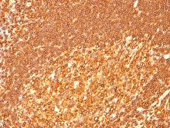 HLA-DRB1 Antibody - Formalin-fixed, paraffin-embedded human tonsil stained with HLA-DRB antibody (HLA-DRB/1067).  This image was taken for the unmodified form of this product. Other forms have not been tested.