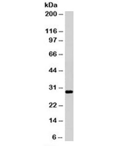 HLA-DRB1 Antibody - Western blot testing of Ramos cell lysate with HLA-DRB1 antibody (clone LN3). Expected molecular weight ~30kDa. This image was taken for the unmodified form of this product. Other forms have not been tested.