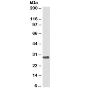 HLA-DRB1 Antibody - Western blot testing of Ramos cell lysate with HLA-DRB1 antibody cocktail (clones LN3 + HLA-DRB/1067). Expected molecular weight ~30kDa. This image was taken for the unmodified form of this product. Other forms have not been tested.