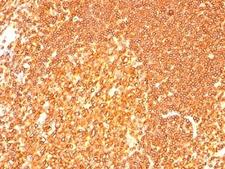 HLA-DRB1 Antibody - IHC: Formalin-fixed, paraffin-embedded human tonsil stained with HLA-DRB1 antibody (LN3 + HLA-DRB/1067).  This image was taken for the unmodified form of this product. Other forms have not been tested.