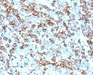 HLA-DRB1 Antibody - IHC analysis of human tonsil and HLA-DRB1 antibody (clone LN3).  This image was taken for the unmodified form of this product. Other forms have not been tested.
