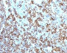 HLA-DRB1 Antibody - IHC testing of FFPE human tonsil and HLA-DRB1 antibody (clone MHDRb2).  This image was taken for the unmodified form of this product. Other forms have not been tested.