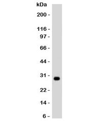 HLA-DRB1 Antibody - Western blot testing of Ramos lysate and HLA-DRB1 antibody (clone MHDRb2). Predicted molecular weight ~28 kDa.  This image was taken for the unmodified form of this product. Other forms have not been tested.