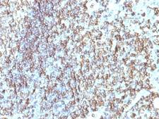 HLA-DRB1 Antibody - Formalin-fixed, paraffin-embedded human tonsil stained with HLA-DRB1 antibody (SPM288).  This image was taken for the unmodified form of this product. Other forms have not been tested.
