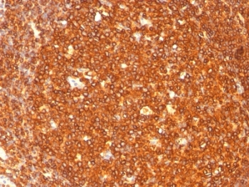 HLA-DRB1 Antibody - Formalin-fixed, paraffin-embedded human tonsil stained with HLA-DRB1 antibody (SPM289).  This image was taken for the unmodified form of this product. Other forms have not been tested.