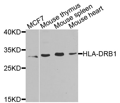 HLA-DRB1 Antibody - Western blot analysis of extracts of various cells.