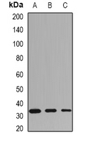 HLA-DRB1 Antibody - Western blot analysis of HLA-DRB1 expression in MCF7 (A); mouse spleen (B); mouse heart (C) whole cell lysates.