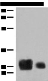 HLA-DRB1 Antibody - Western blot analysis of Human spleen tissue and A375 cell lysates  using HLA-DRB1 Polyclonal Antibody at dilution of 1:500