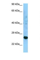 HLA-DRB3 Antibody - HLA-DRB3 antibody Western blot of U937 Cell lysate. Antibody concentration 1 ug/ml.  This image was taken for the unconjugated form of this product. Other forms have not been tested.
