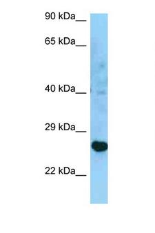 HLA-DRB3 Antibody - HLA-DRB3 antibody Western blot of U937 Cell lysate. Antibody concentration 1 ug/ml.  This image was taken for the unconjugated form of this product. Other forms have not been tested.