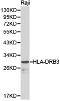 HLA-DRB3 Antibody - Western blot of extracts of Raji cell lines, using HLA-DRB3 antibody.