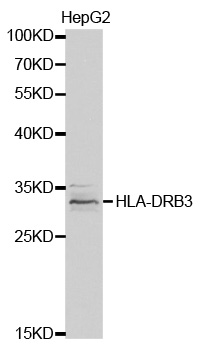 HLA-DRB3 Antibody - Western blot analysis of extracts of HepG2 cell lines.