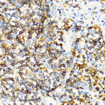HLA-DRB3 Antibody - Immunohistochemistry of paraffin-embedded human vermiform appendix tissue.