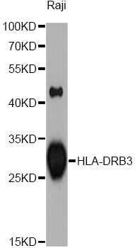 HLA-DRB3 Antibody - Western blot analysis of extracts of Raji cells, using HLA-DRB3 antibody at 1:1000 dilution. The secondary antibody used was an HRP Goat Anti-Rabbit IgG (H+L) at 1:10000 dilution. Lysates were loaded 25ug per lane and 3% nonfat dry milk in TBST was used for blocking. An ECL Kit was used for detection and the exposure time was 90s.