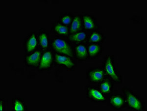 HLA-DRB3 Antibody - Immunofluorescent analysis of A549 cells at a dilution of 1:100 and Alexa Fluor 488-congugated AffiniPure Goat Anti-Rabbit IgG(H+L)