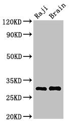HLA-DRB3 Antibody - Positive Western Blot detected in Raji whole cell lysate, Mouse brain tissue. All lanes: HLA-DRB3 antibody at 3.5 µg/ml Secondary Goat polyclonal to rabbit IgG at 1/50000 dilution. Predicted band size: 30 KDa. Observed band size: 30 KDa