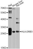 HLA-DRB3 Antibody - Western blot analysis of extracts of various cell lines, using HLA-DRB3 antibody at 1:1000 dilution. The secondary antibody used was an HRP Goat Anti-Rabbit IgG (H+L) at 1:10000 dilution. Lysates were loaded 25ug per lane and 3% nonfat dry milk in TBST was used for blocking. An ECL Kit was used for detection and the exposure time was 30s.