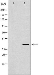 HLA-DRB3 Antibody - Western blot analysis of extracts of HepG2 cells using HLA-DRB3 antibody. The lane on the left is treated with the antigen-specific peptide.