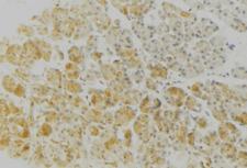 HLA-DRB3 Antibody - 1:100 staining human gastric tissue by IHC-P. The sample was formaldehyde fixed and a heat mediated antigen retrieval step in citrate buffer was performed. The sample was then blocked and incubated with the antibody for 1.5 hours at 22°C. An HRP conjugated goat anti-rabbit antibody was used as the secondary.