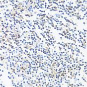 HLA-DRB3 Antibody - Immunohistochemistry of paraffin-embedded Human tonsil using HLA-DRB3 Polyclonal Antibody at dilution of 1:100 (40x lens).