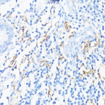 HLA-DRB3 Antibody - Immunohistochemistry of paraffin-embedded Human appendix using HLA-DRB3 Polyclonal Antibody at dilution of 1:100 (40x lens).