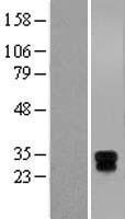 HLA-DRB3 Protein - Western validation with an anti-DDK antibody * L: Control HEK293 lysate R: Over-expression lysate