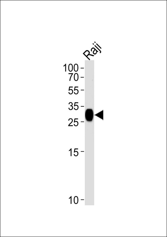 HLA-DRB4 Antibody - Western blot of lysate from Raji cell line, using HLA-DRB4 Antibody. Antibody was diluted at 1:1000 at each lane. A goat anti-rabbit IgG H&L (HRP) at 1:5000 dilution was used as the secondary antibody. Lysate at 35ug per lane.