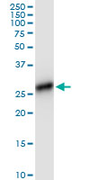HLA-DRB4 Antibody - HLA-DRB4 monoclonal antibody (M01), clone 4C8. Western blot of HLA-DRB4 expression in human kidney.