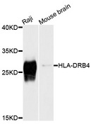HLA-DRB4 Antibody - Western blot analysis of extracts of various cell lines, using HLA-DRB4 antibody at 1:1000 dilution. The secondary antibody used was an HRP Goat Anti-Rabbit IgG (H+L) at 1:10000 dilution. Lysates were loaded 25ug per lane and 3% nonfat dry milk in TBST was used for blocking. An ECL Kit was used for detection and the exposure time was 1s.