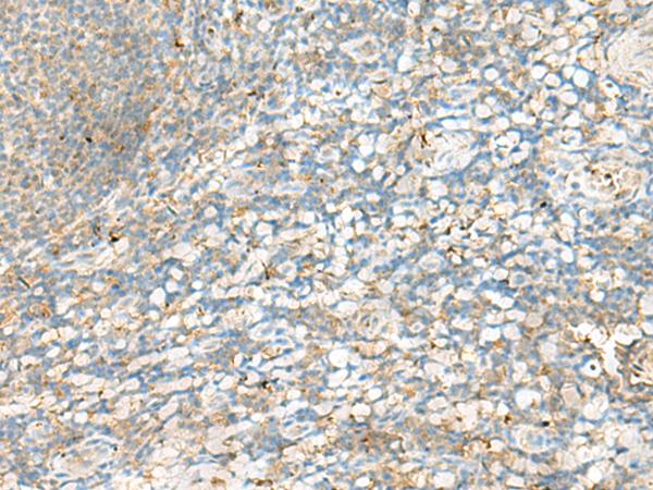 HLA-DRB4 Antibody - Immunohistochemistry of paraffin-embedded Human tonsil tissue  using HLA-DRB4 Polyclonal Antibody at dilution of 1:60(×200)