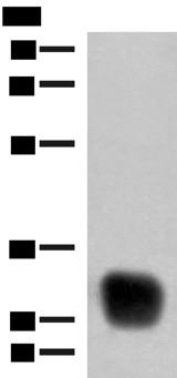 HLA-DRB4 Antibody - Western blot analysis of Raji cell lysate  using HLA-DRB4 Polyclonal Antibody at dilution of 1:350