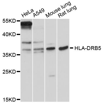 HLA-DRB5 Antibody - Western blot analysis of extracts of various cell lines, using HLA-DRB5 antibody at 1:3000 dilution. The secondary antibody used was an HRP Goat Anti-Rabbit IgG (H+L) at 1:10000 dilution. Lysates were loaded 25ug per lane and 3% nonfat dry milk in TBST was used for blocking. An ECL Kit was used for detection and the exposure time was 10s.