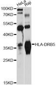 HLA-DRB5 Antibody - Western blot analysis of extracts of various cell lines, using HLA-DRB5 antibody at 1:3000 dilution. The secondary antibody used was an HRP Goat Anti-Rabbit IgG (H+L) at 1:10000 dilution. Lysates were loaded 25ug per lane and 3% nonfat dry milk in TBST was used for blocking. An ECL Kit was used for detection and the exposure time was 10s.
